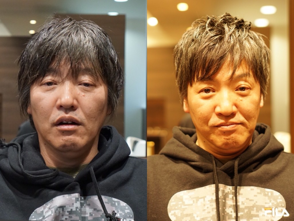 ビフォーアフター　まとめ　2017年　3月編